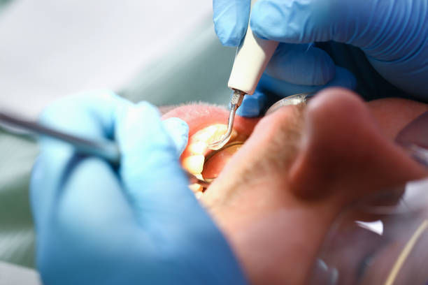 Best Chipped Tooth Repair Near Me  in Prospect Heights, IL