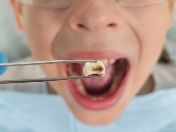 Best Urgent Tooth Repair  in Prospect Heights, IL